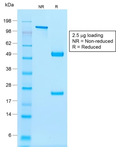 NKX2-2 Antibody (clone rNX2/294, Azide-free, Carrier-free)