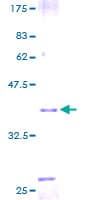 Human TFF2 / SP Protein (Recombinant GST)