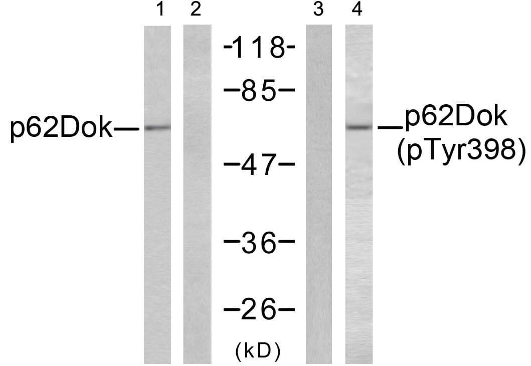 DOK1 Antibody (p398)