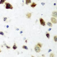 RENT1 / UPF1 Antibody