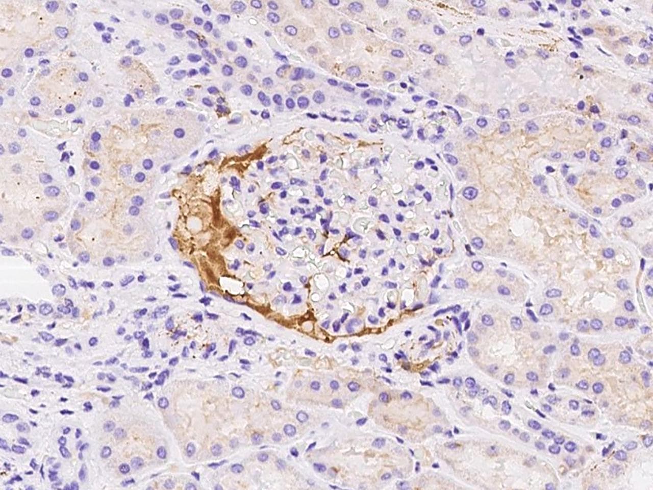 VTN / Vitronectin Antibody