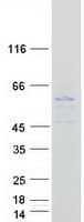Human TMEM79 Protein (Recombinant Myc-DDK (Flag))