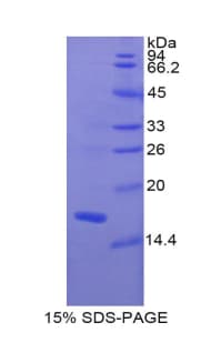 Rat MLC3F / MYL1 Protein (Recombinant His)