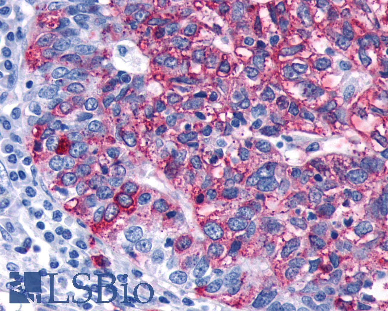 PathPlus™ Polyclonal Rabbit anti-Human FZD3 / Frizzled 3 Antibody (IHC)
