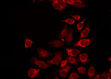 DLEC1 / DLC1 Antibody