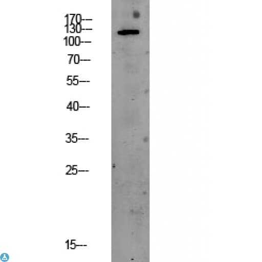 Polyclonal Rabbit anti-Human EIF2AK3 / PERK Antibody (WB)