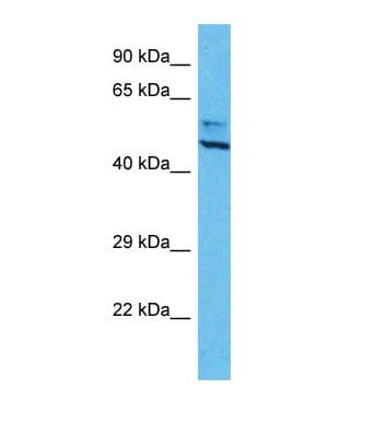 Polyclonal Rabbit anti-Human AURKA / Aurora-A Antibody (aa151-200, WB)