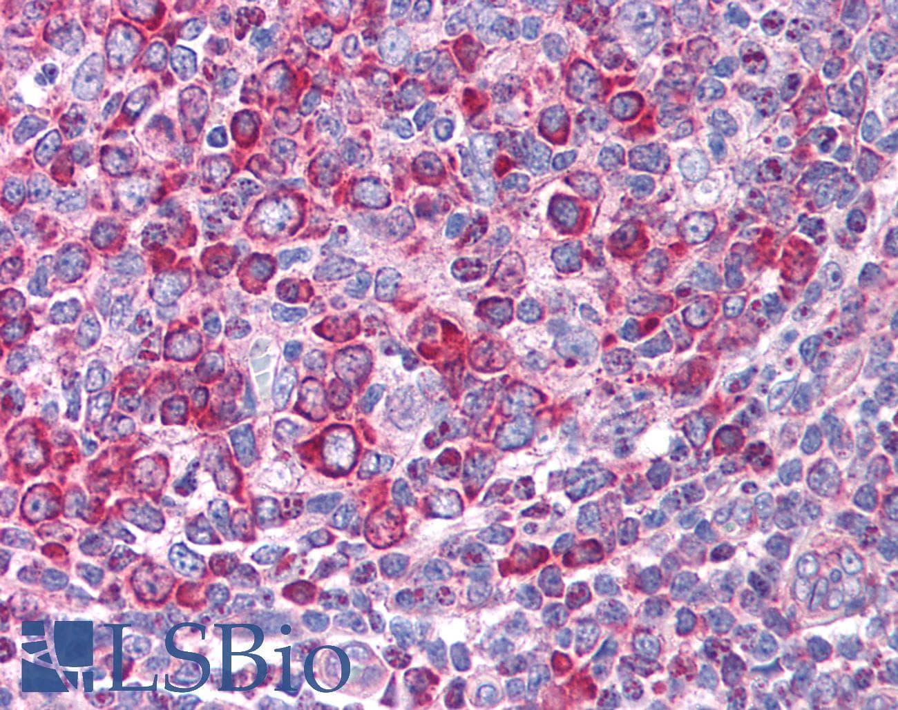 LEF1 Antibody (aa51-100)