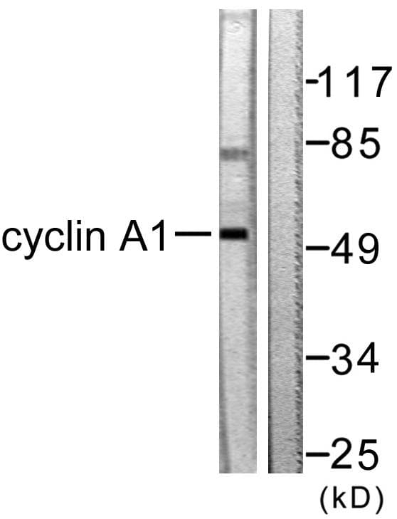 Polyclonal Rabbit anti-Human CCNA1 / Cyclin A1 Antibody (IHC, WB)