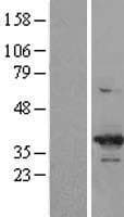 Human CDK6 Protein (Over-Expression Lysate Myc-DDK (Flag))