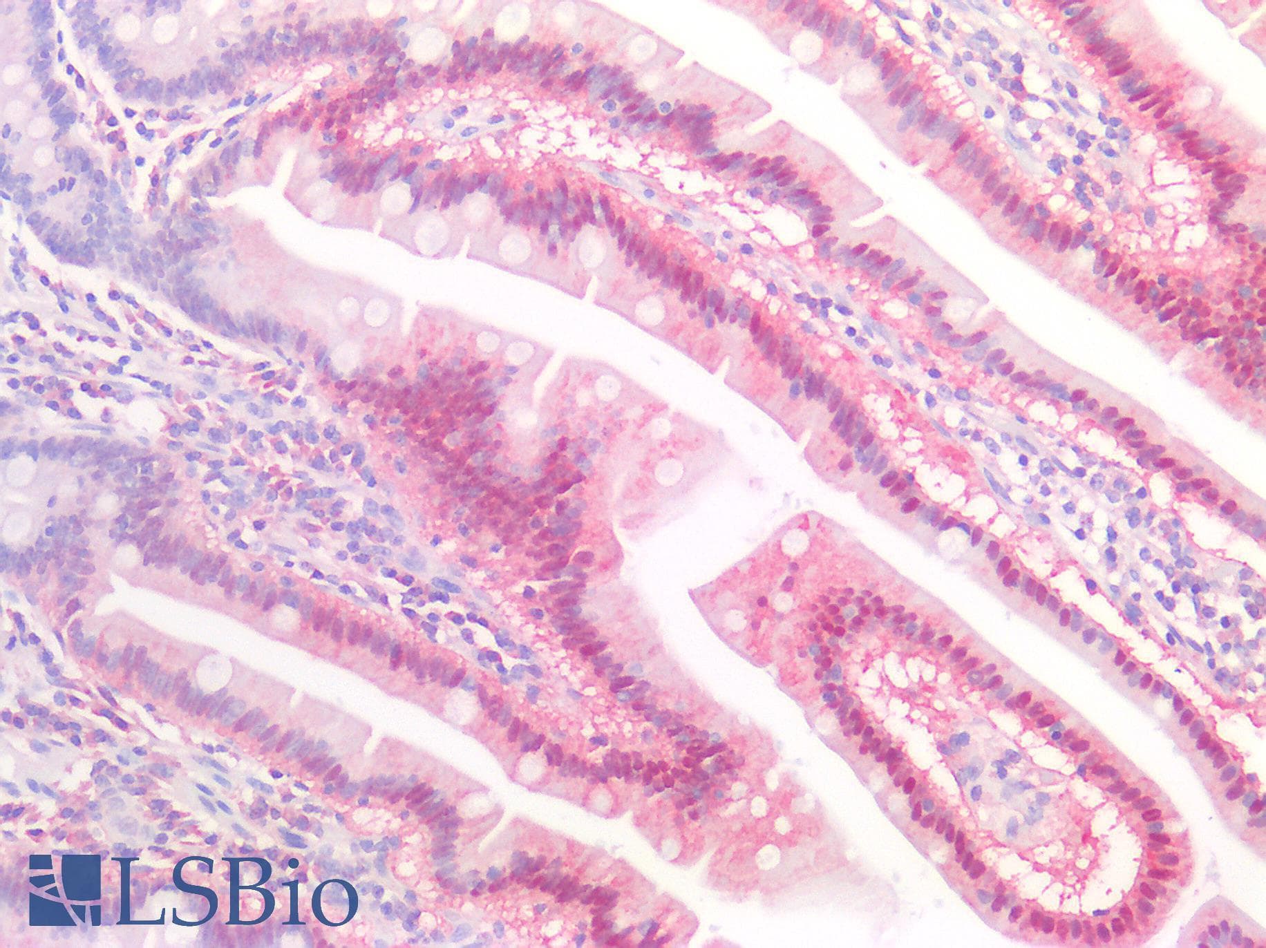 IHC-plus™ SAT2 Antibody (clone OTI2A3)