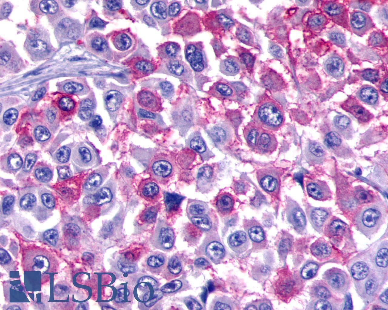PathPlus™ ADGRB3 / BAI3 Antibody (C-Terminus)
