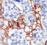 PIP4K2B Antibody (aa286-317)