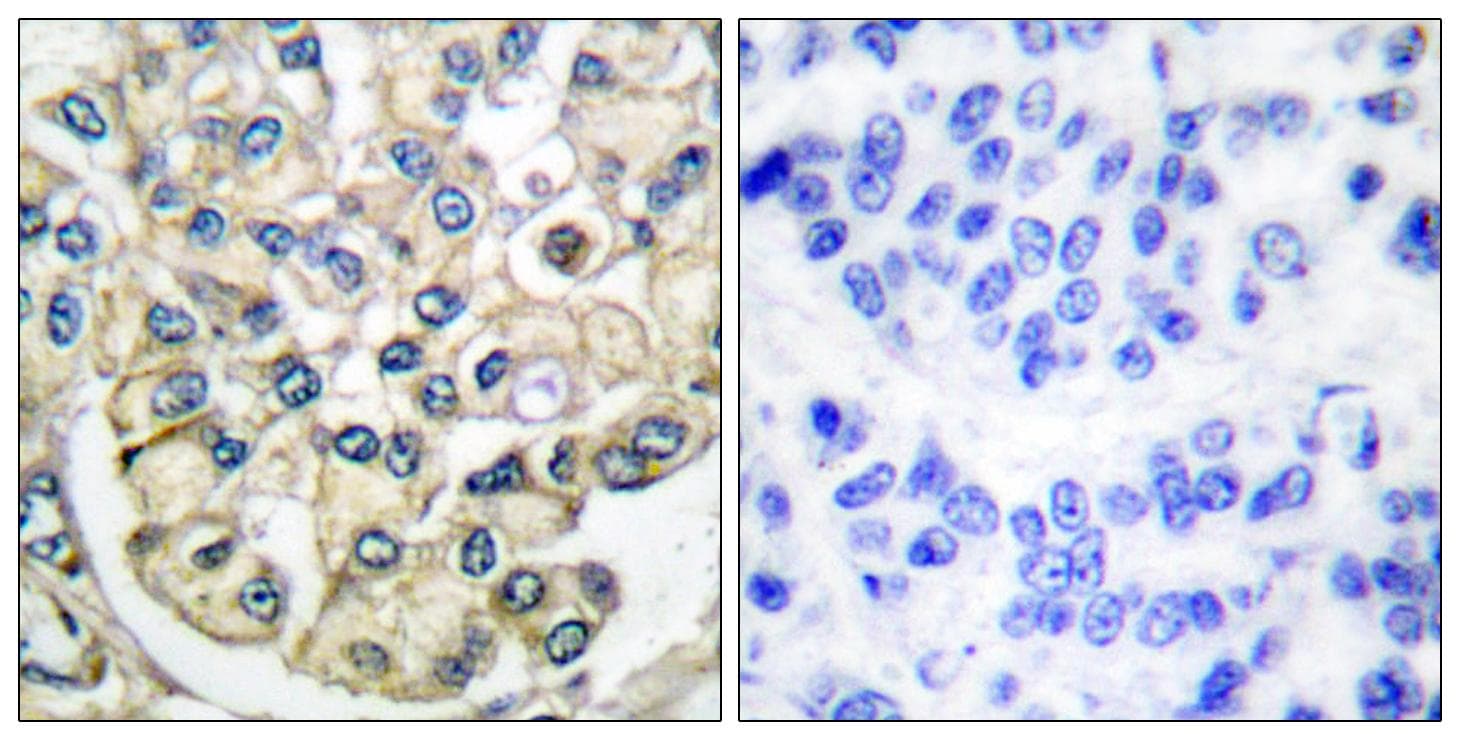 Polyclonal Rabbit anti-Human FGFR2 / FGF Receptor 2 Antibody (IHC, WB)