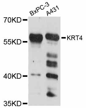 KRT4 / CK4 / Cytokeratin 4 Antibody