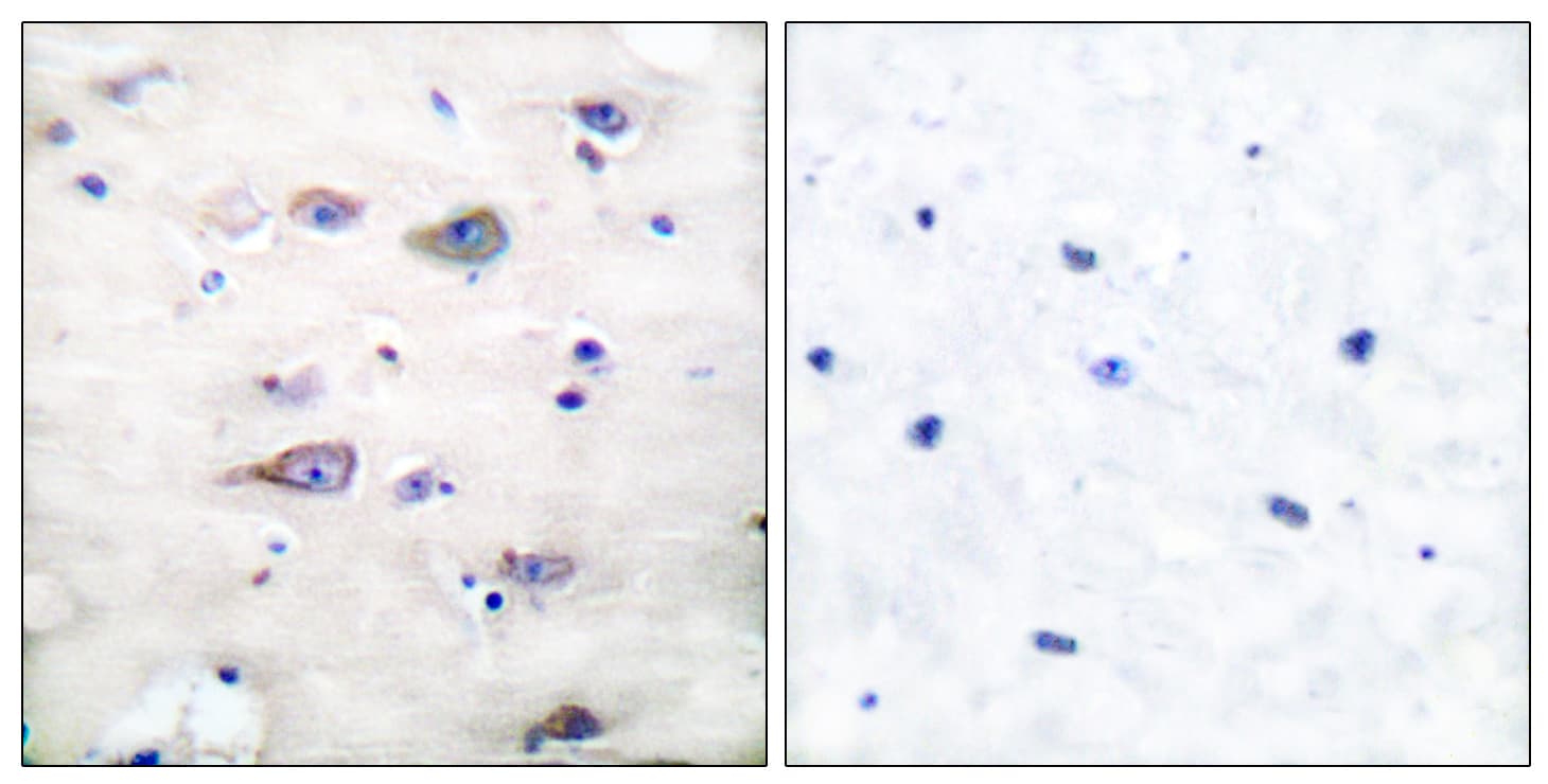 GRIA2 / GLUR2 Antibody (phospho-Ser880)