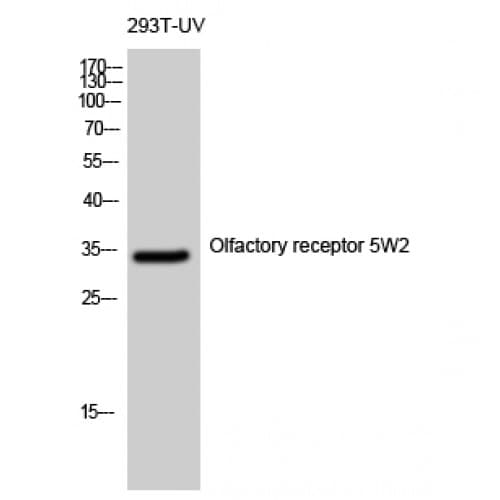 OR5W2 Antibody (130-210 aa, Internal)