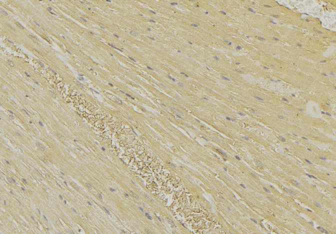 HEXB Antibody