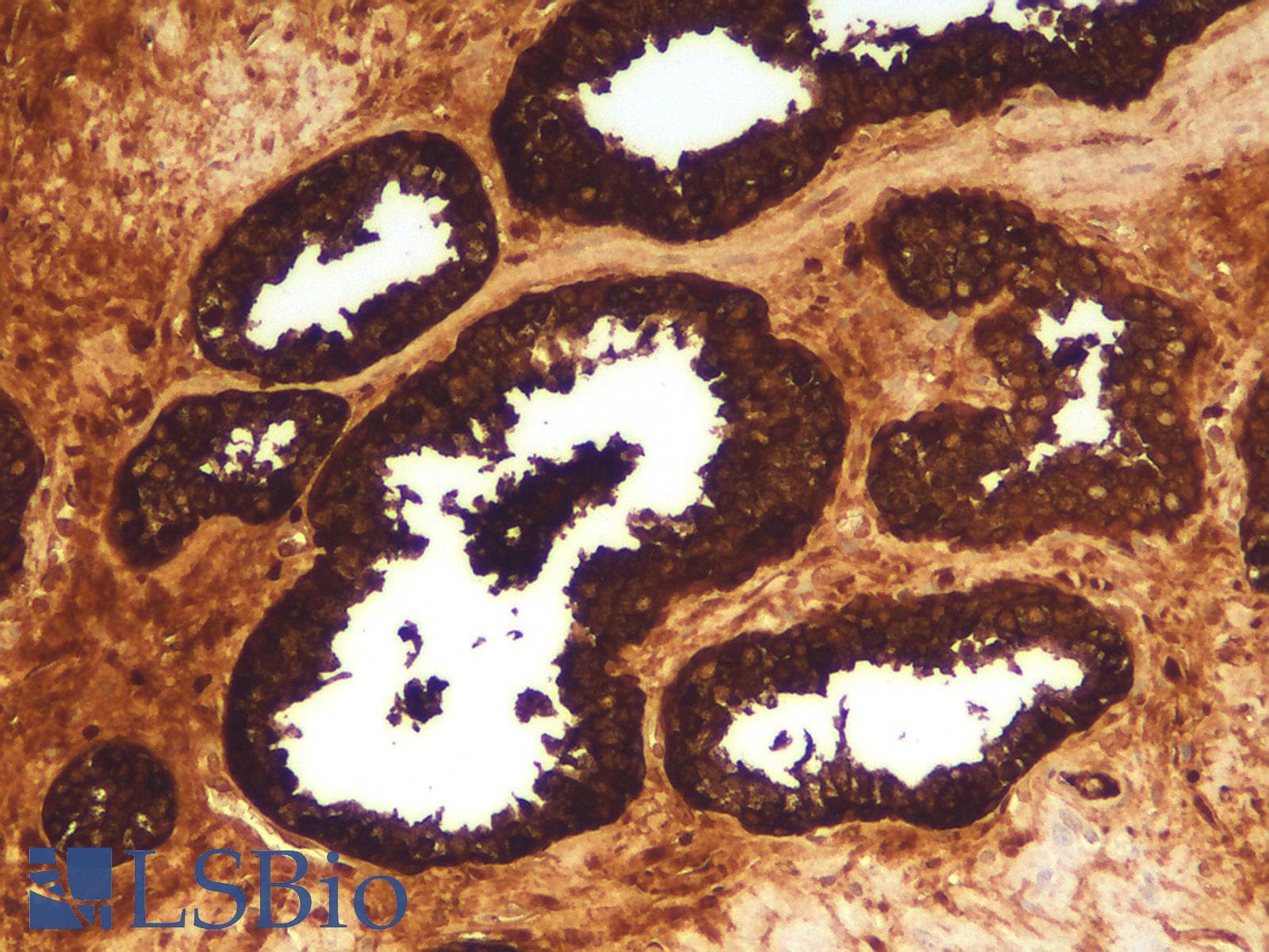 PathPlus™ ACPP / PAP Antibody (clone rACPP/1338)
