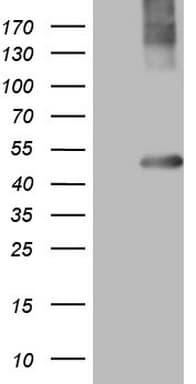 Monoclonal Mouse anti-Human MTOR Antibody (clone OTI5B8, aa1766-2144, IHC, WB)