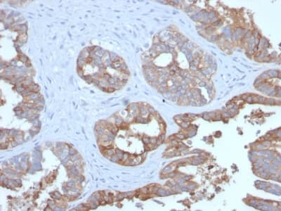 Recombinant Monoclonal Rabbit anti-Human EMA / MUC1 Antibody (clone MUC1/2729R, IHC)