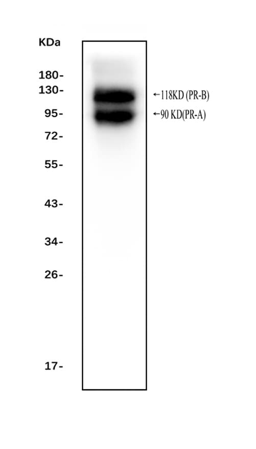 PR / Progesterone Receptor Antibody (aa595-933)