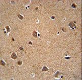 AKT3 Antibody
