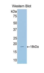 SUOX / Sulfite Oxidase Antibody (aa396-537)