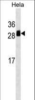 TMED1 / ST2L Antibody (aa77-104)
