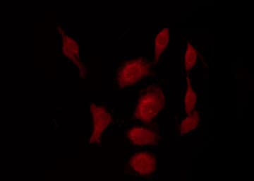 CDK1 / CDC2 Antibody (phospho-Thr14)
