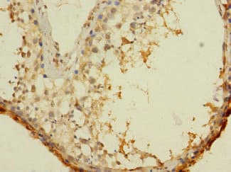 ASZ1 / Orf3 Antibody