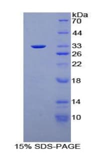 Human PKN1 Protein (Recombinant His-T7)