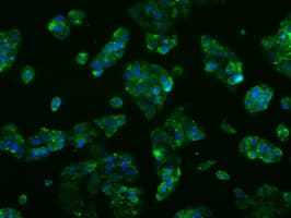 Monoclonal Mouse anti-Human CYP2E1 Antibody (clone OTI9E6, IHC, IF, WB)