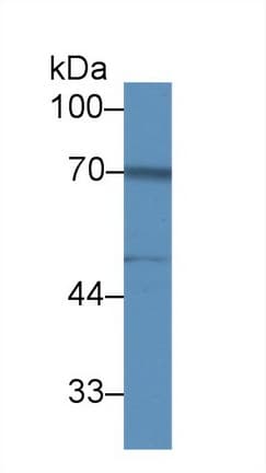 FKBP10 / FKBP65 Antibody (aa158-440)