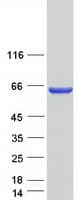 Human CCDC149 Protein (Recombinant Myc-DDK (Flag))