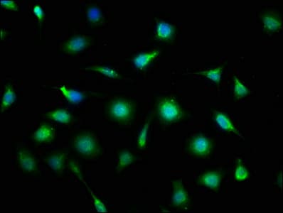 AF1Q / MLLT11 Antibody