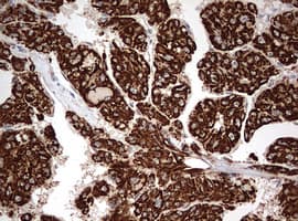 OTC Antibody (aa33-354, clone OTI2C2)