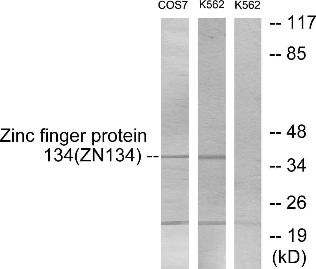 ZNF134 Antibody (aa116-165)