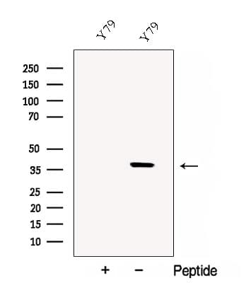 CRD / CRX Antibody