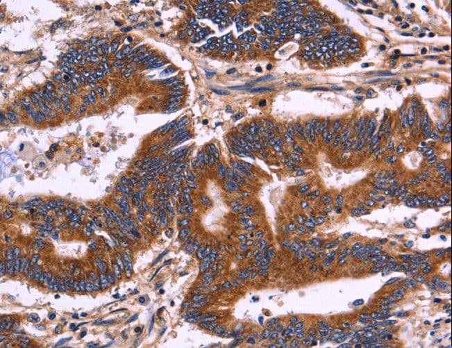 KIR2DL1+3+4 + KIR2DS4 Antibody