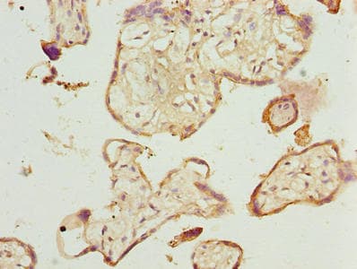 TMEM143 Antibody
