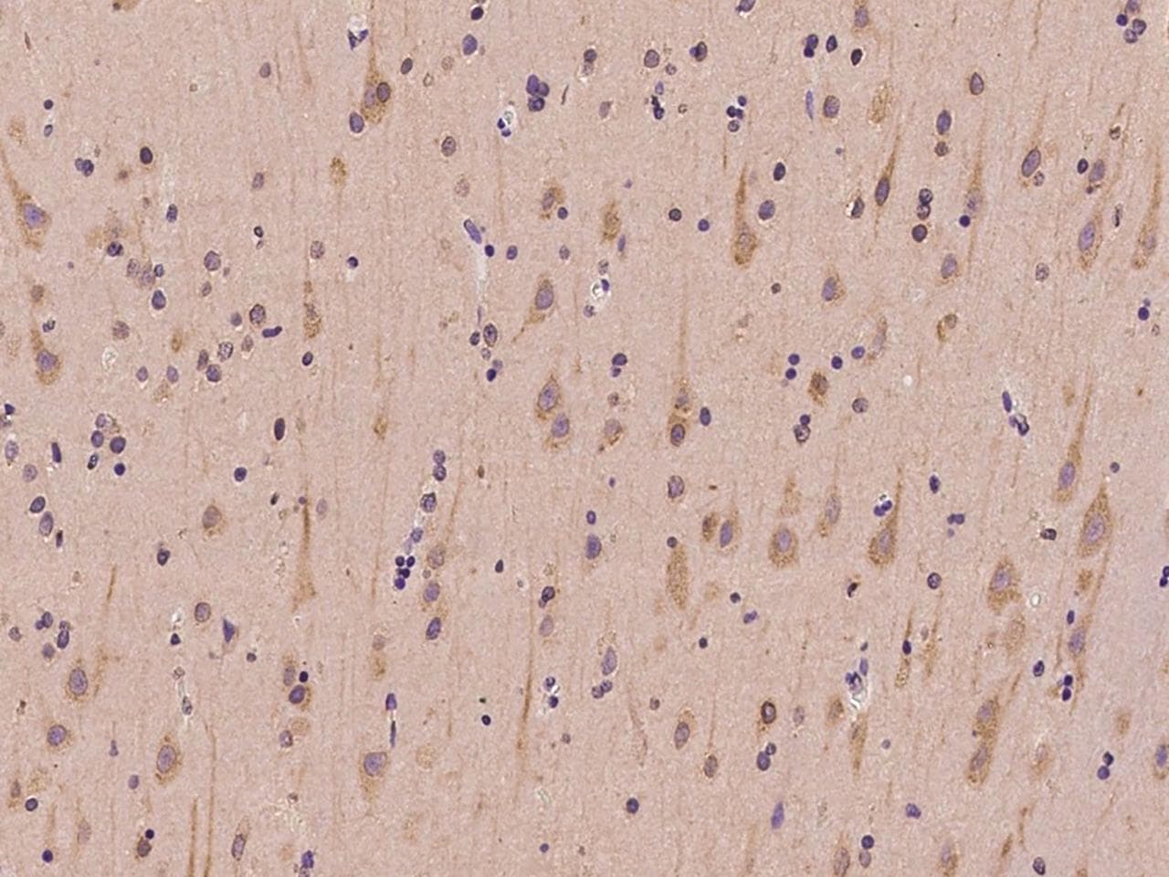 Polyclonal Rabbit anti-Human SLC41A3 Antibody (IHC)