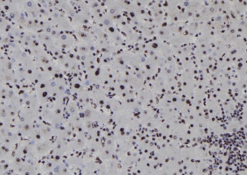 Polyclonal Rabbit anti-Human SOX1 Antibody (IHC, WB)