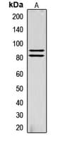 LIPE / HSL Antibody (phospho-Ser855)