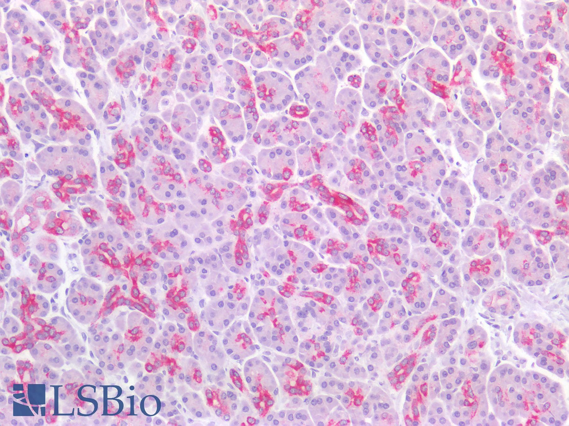 PathPlus™ KRT4 / CK4 / Cytokeratin 4 Antibody (clone 5H5)