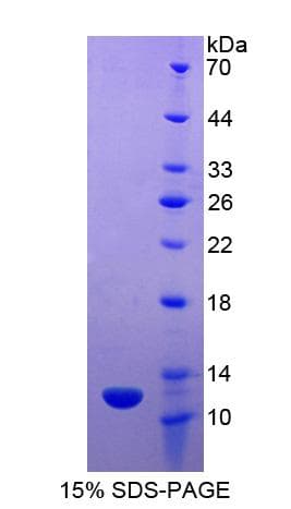 Horse APOC2 / Apolipoprotein C II (Recombinant His-S)