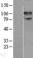 GRIN1 / NMDAR1 Protein (Over-Expression Lysate Myc-DDK (Flag))