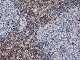 Monoclonal Mouse anti-Human PIP4K2A / PIPK Antibody (clone 3D3, Carrier-free, IHC, WB)