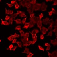 PRDX5 / Peroxiredoxin 5 Antibody