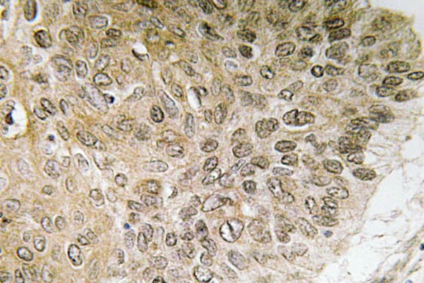 PIK3R1 / p85 Alpha Antibody (aa449-498)